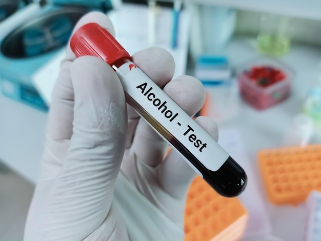 Drug and Alcohol Testing in Workplaces